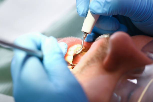 Best Emergency Treatment for Toothache in Marine, IL